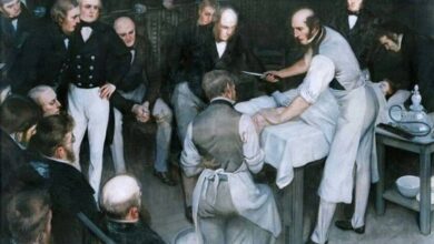 Robert Liston, cirujano más rápido de Londres, anestesia, cirugía moderna