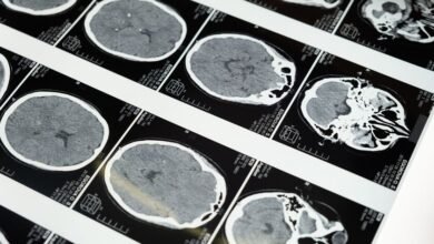 La salud metabólica y el estilo de vida en la prevención de la demencia