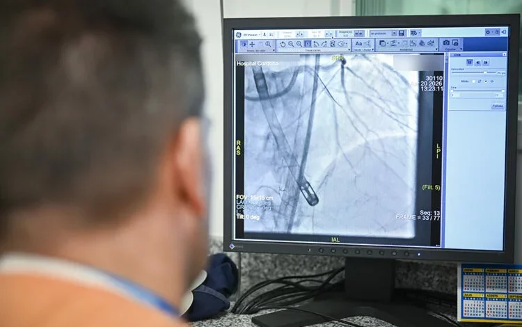 Equipo médico realizando una angioplastia coronaria con soporte mecánico