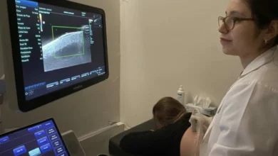 Transductor de alta frecuencia de 15 MHz integrado al ecógrafo MINDRAY DC‑70 en el Hospital San Roque